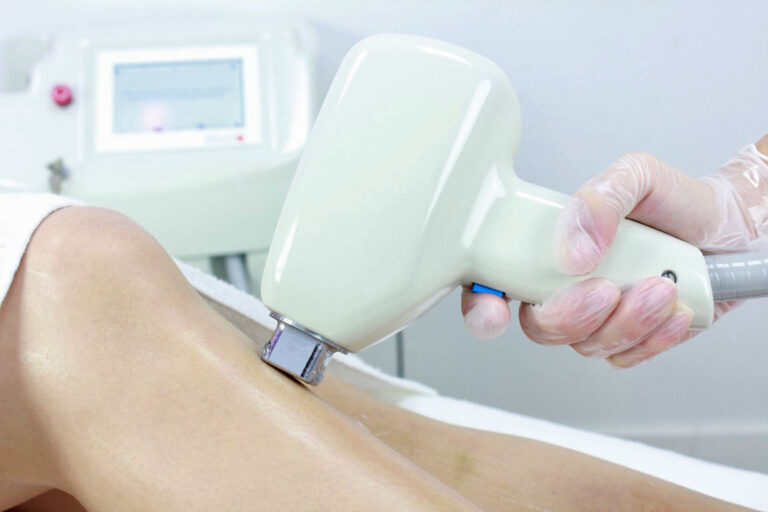 ¿Por qué el láser Diodo es la opción más eficiente para la depilación definitiva?