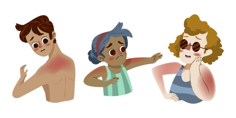 cuidado de la piel en verano