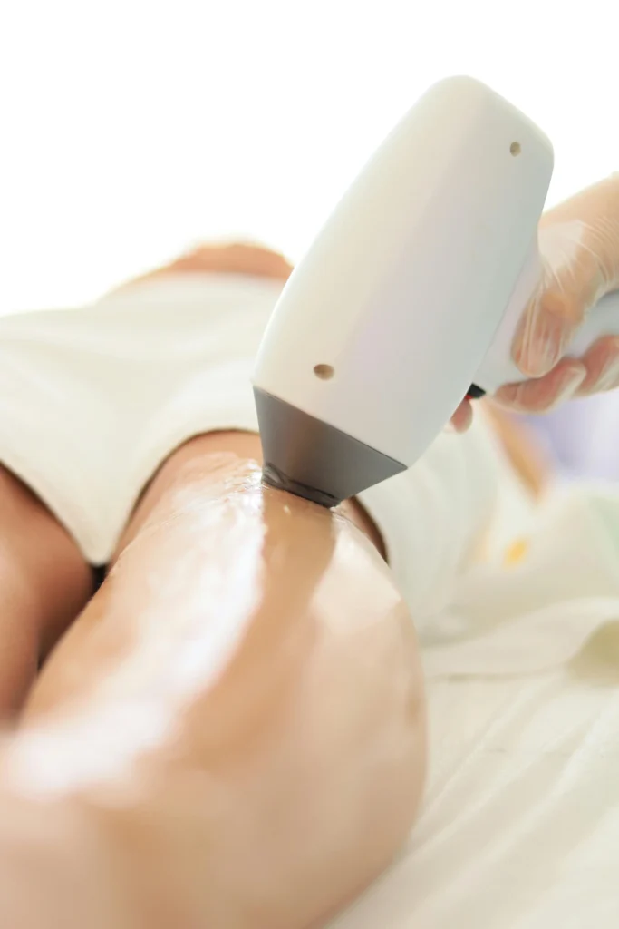 depilación láser en kirei estetica depilación láser en kirei estetica